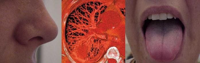 Article image of: Stof-, damp en gasmonitoring