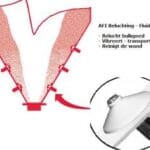 Article image of: Beluchtingschijven sterk in prijs gedaald